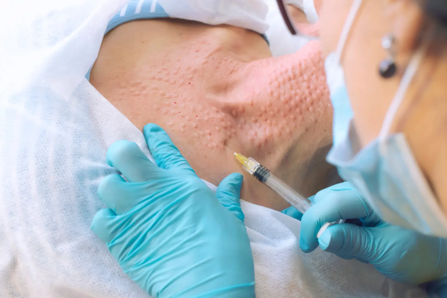 Der Kosmetiker injiziert den Patienten in den Hals. Erste Ansicht. Nahaufnahme